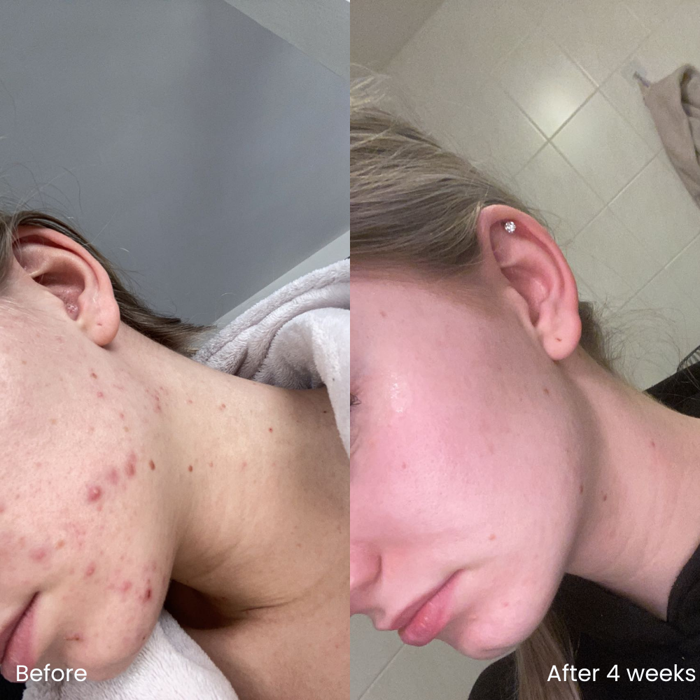 Niacinamide Clear Skin Serum
