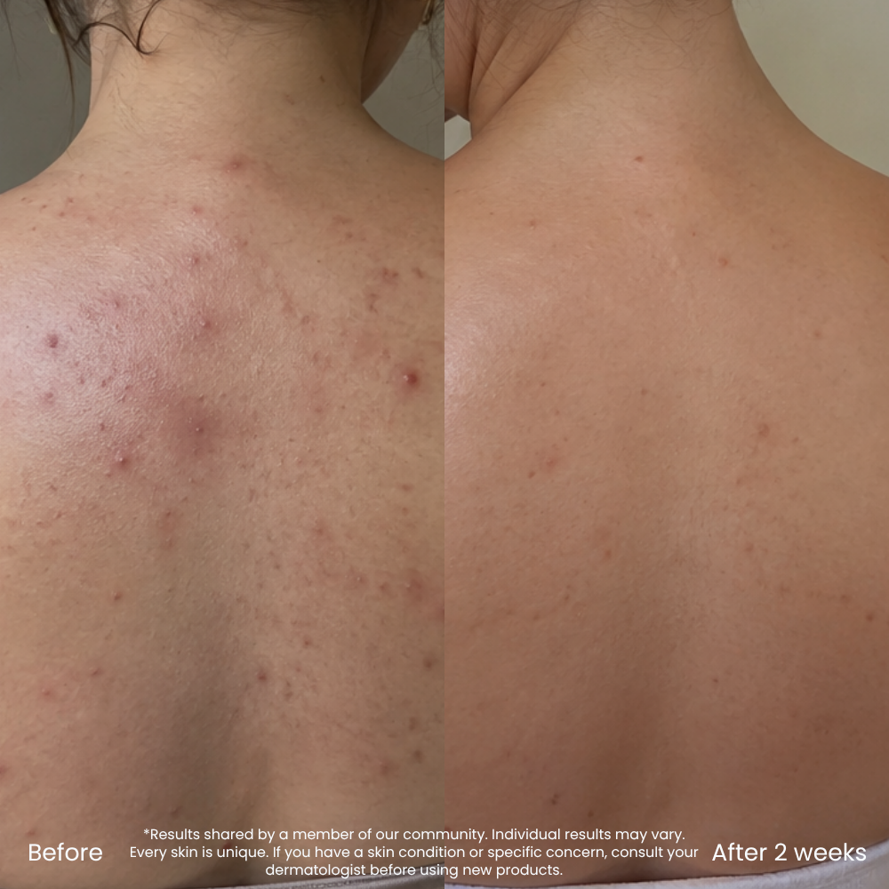 Hyaluronic Acid Hydrating Body Lotion For Dry Skin