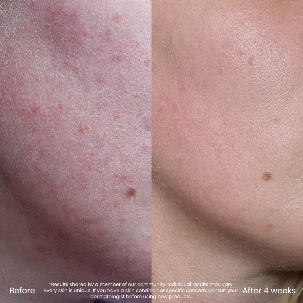 2% Hyaluronic Acid Serum For Dry & Dehydrated Skin