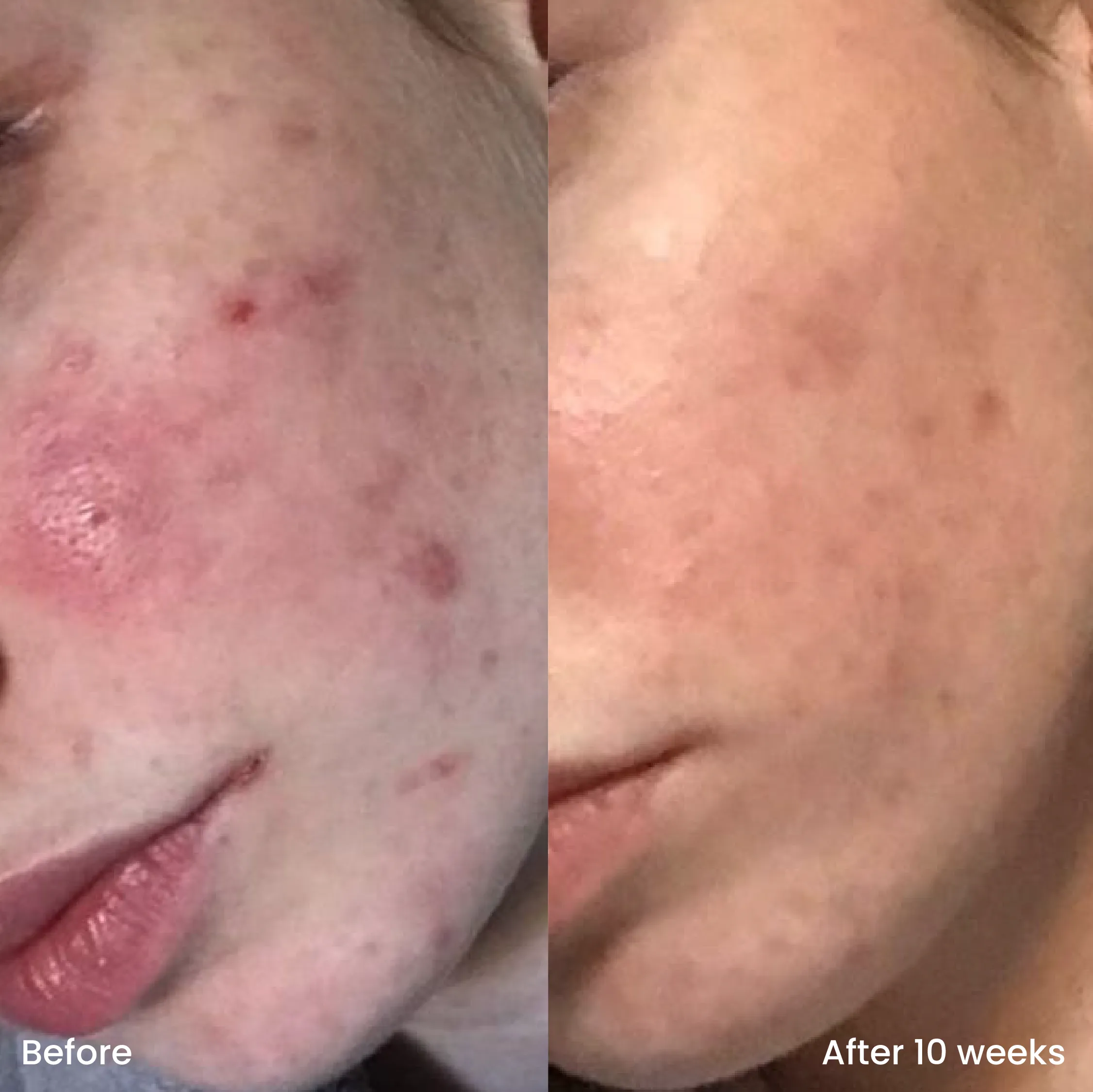 Old branding sale: Pink clay mask