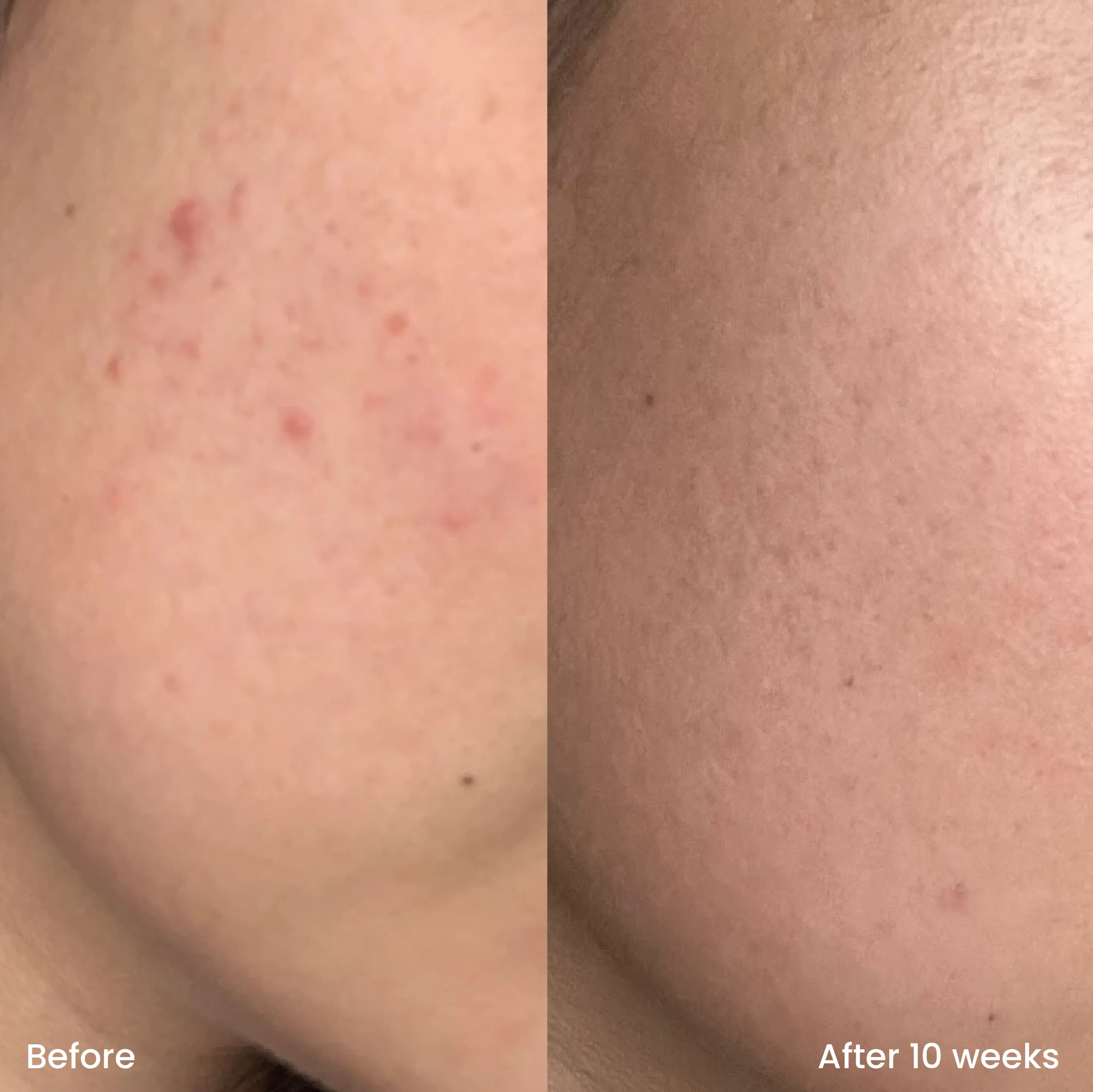 Triple AHA Straw-Jelly Cleanser