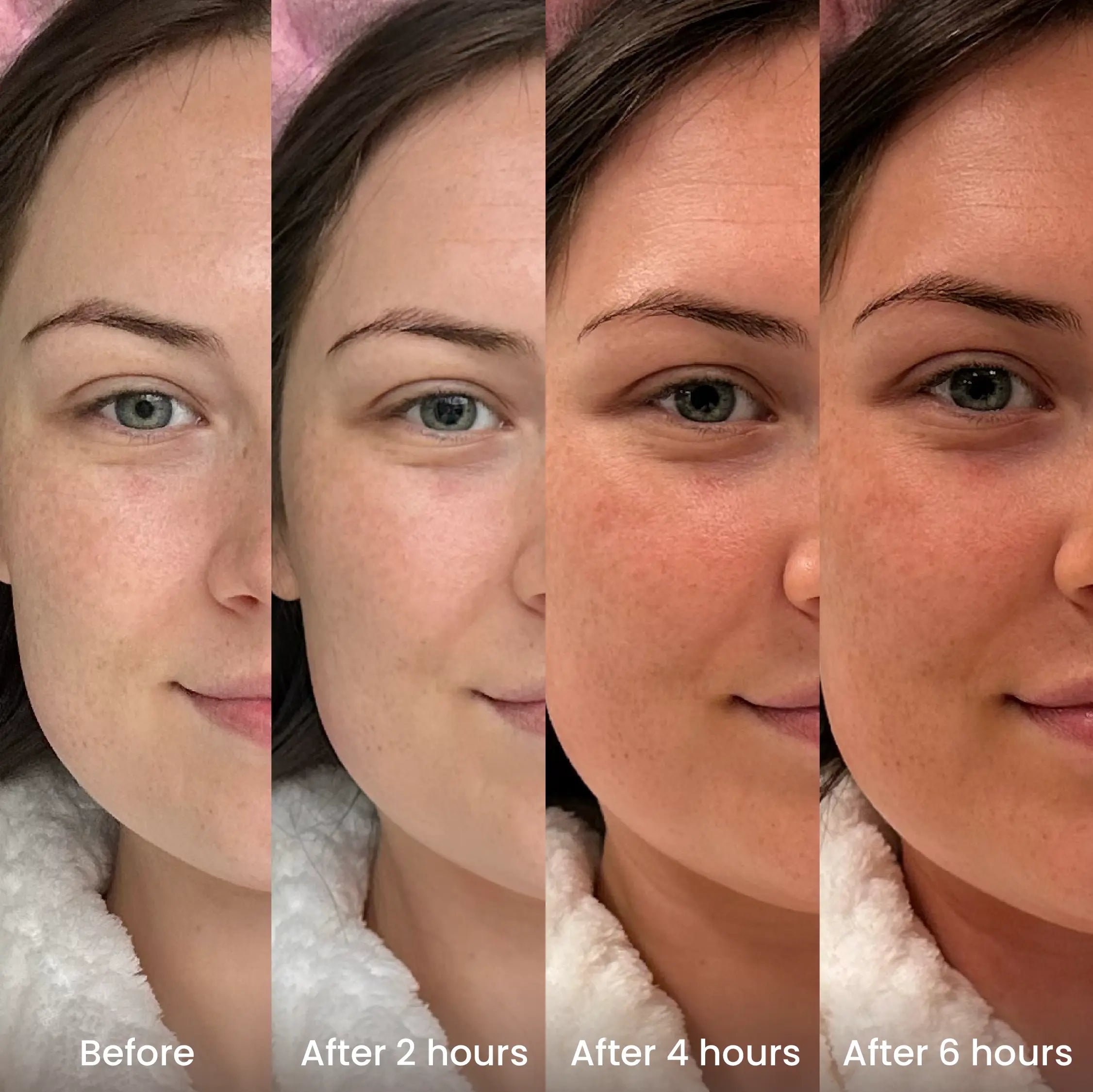 Hyaluronic acid tanning drops