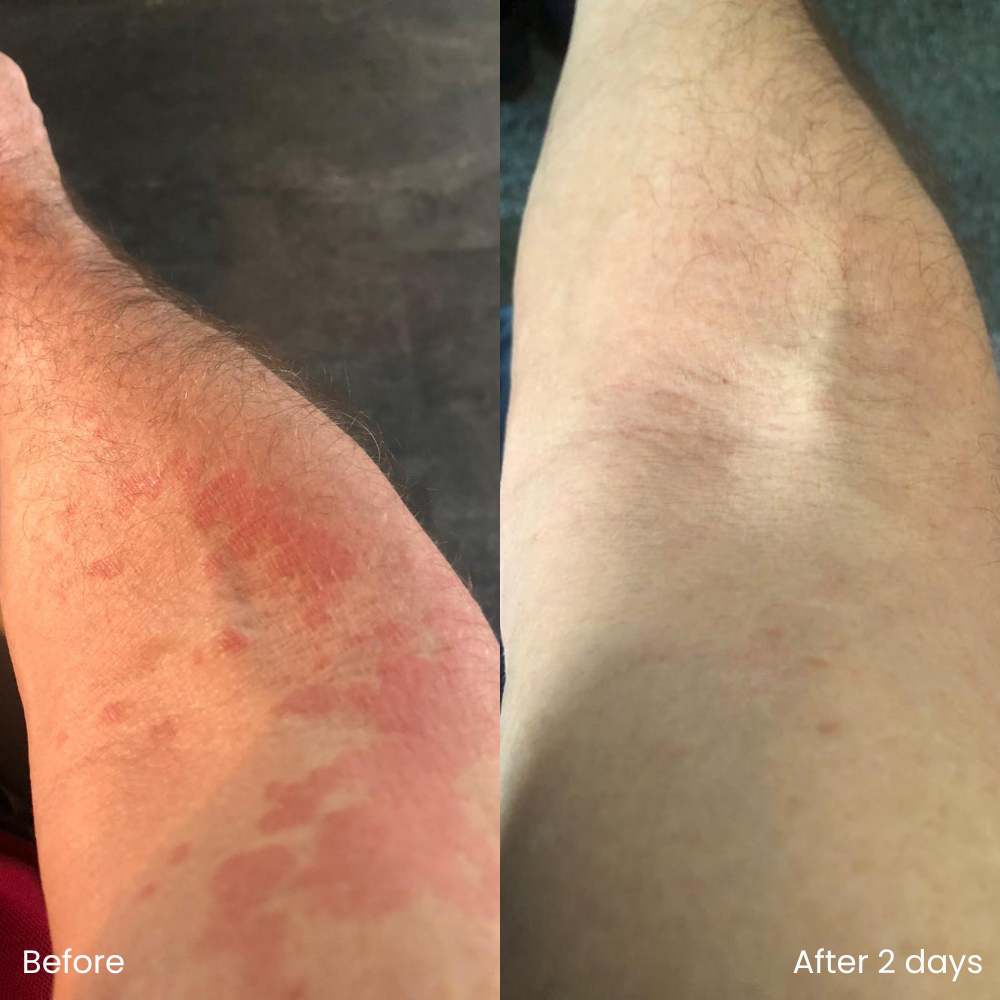 Hydrating moisturizer