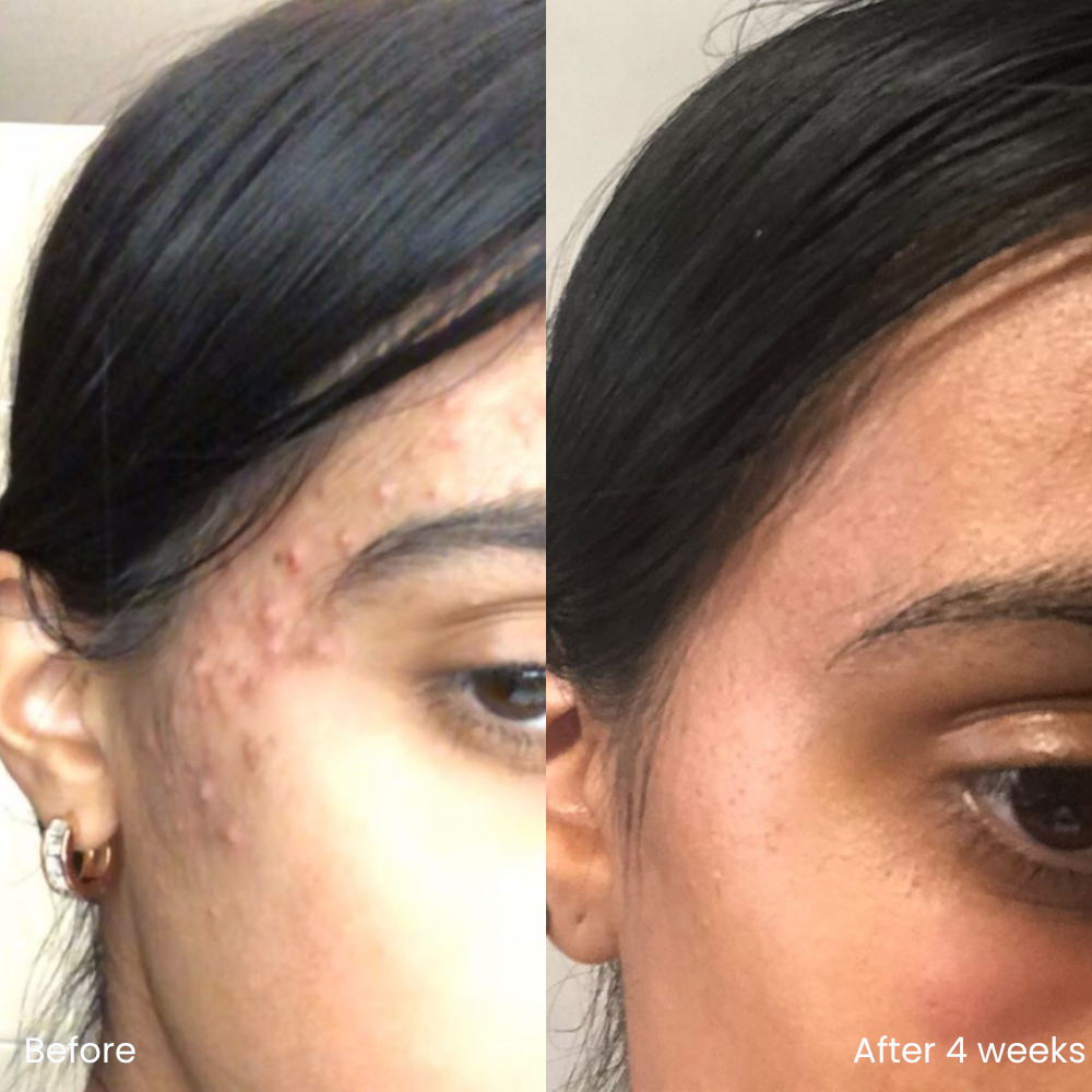 BHA/AHA exfoliant