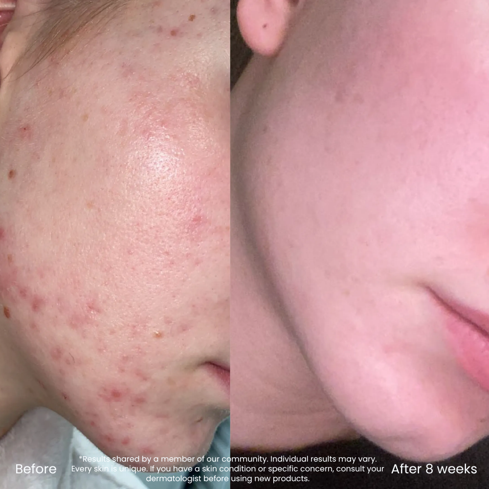 Hyaluronic Acid Hydrating Toner For Dry & Dehydrated Skin