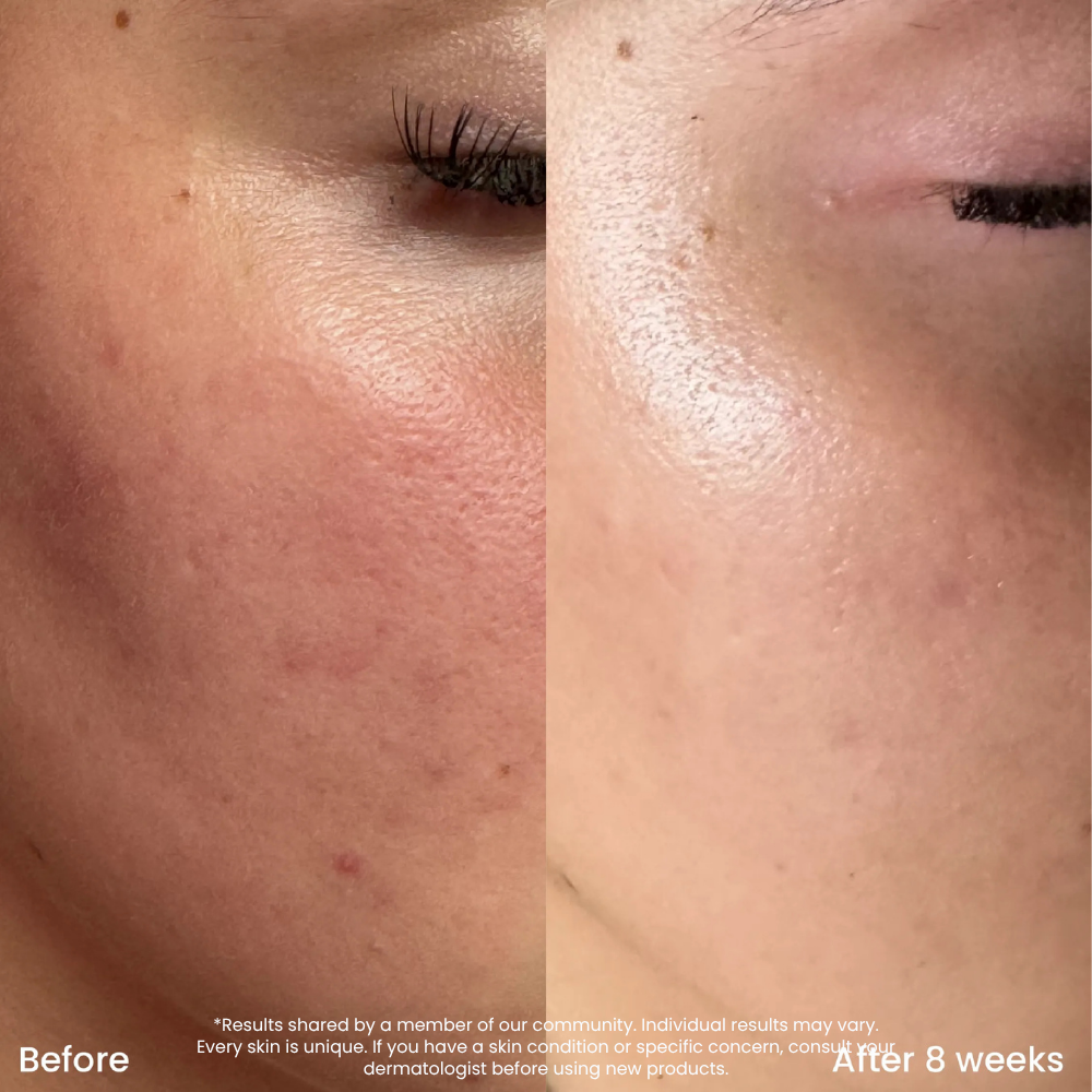 Niacinamide Clear Skin Serum