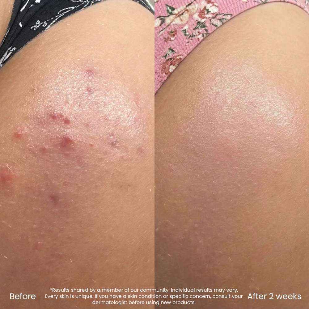 Hyaluronic Acid Hydrating Body Lotion For Dry Skin