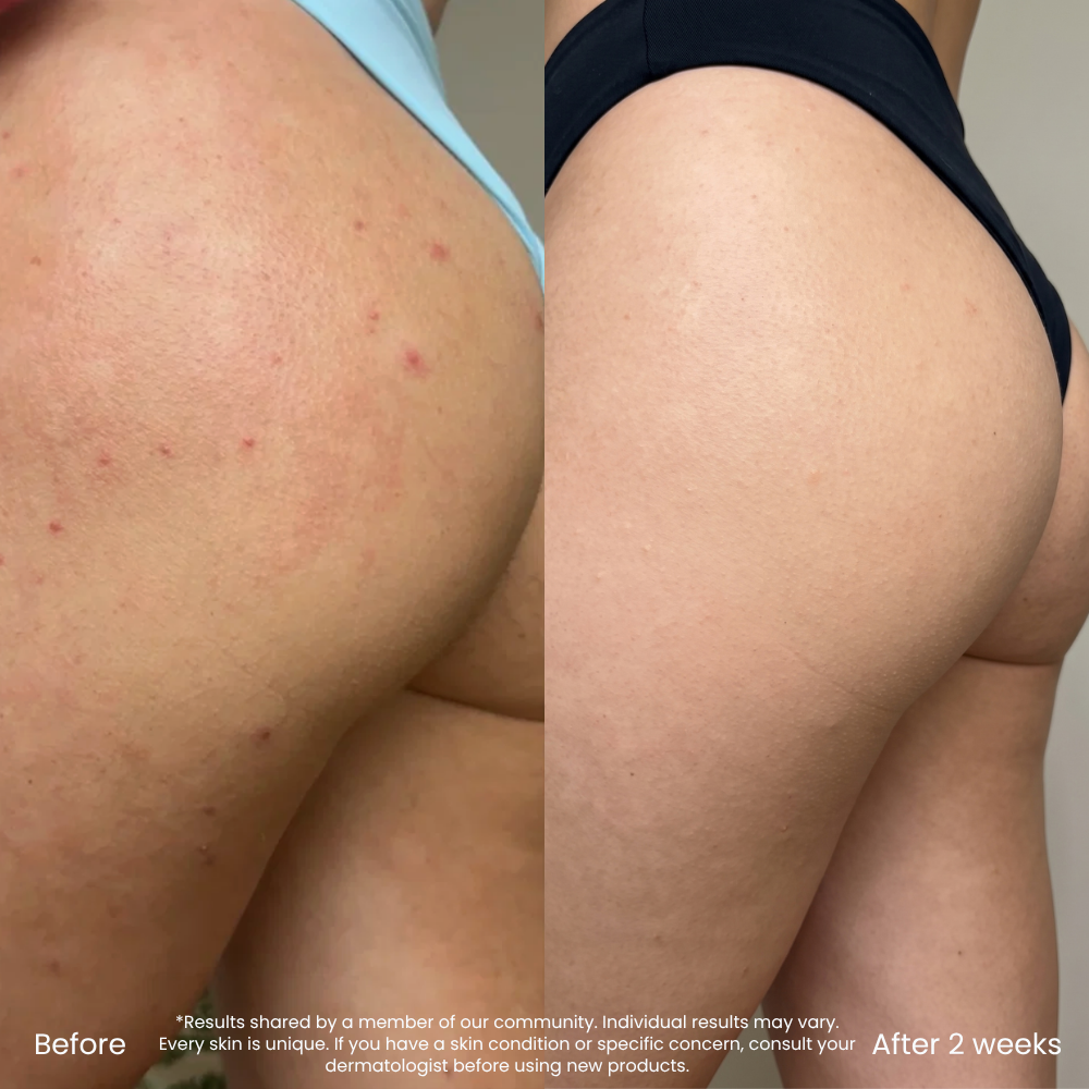 Hyaluronic Acid Hydrating Body Lotion For Dry Skin